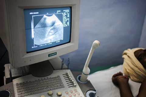 A sonographic image is displayed on a monitor as a patient undergoes an ultrasound scan in Bikaner, Rajasthan. (Photographer: Prashanth Vishwanathan/Bloomberg)