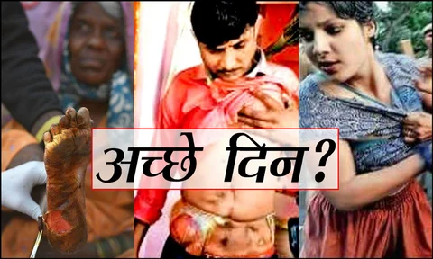 किसान पैरों में छाले, छात्र आंखों में आंसू और जवान पॉलिथिन में आंते लिए घूम रहा है! ये है PM मोदी के अच्छे दिन ?