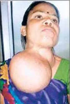MH doctors perform rare surgery