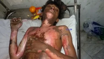 Why Justice Still Eludes Sawan Rathore - A Forgotten Dalit From Maharashtra