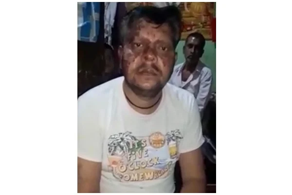 Narendra Kumar after the attack 