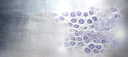 Silver treats cancer as effectively as chemo