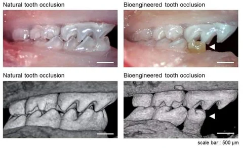 Stem cells used to grow new teeth