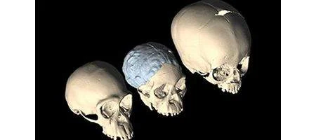 Babies' unfused skulls linked to bipedalism