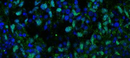Team grows retina from stem cells