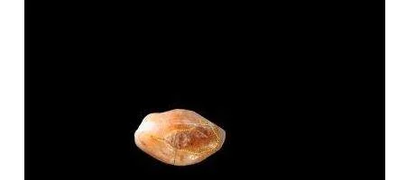 World's oldest dental filling found