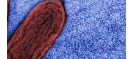 'Bacterial nanowires' could revolutionise bioelectronics