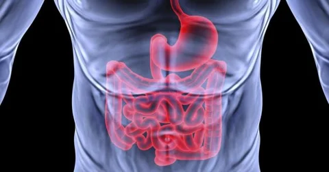 Natural remedies for Hiatal Hernia that you should follow