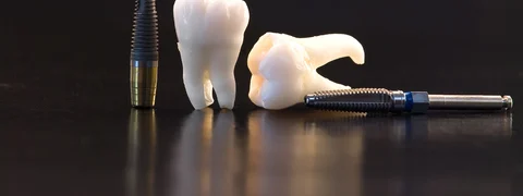 Dental Implants