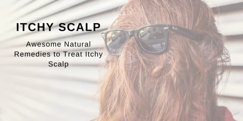 Awesome Natural Remedies To Treat Itchy Scalp