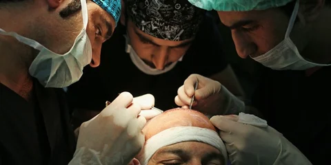 Hair Transplantation