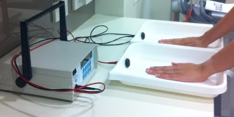 Iontophoresis Treatment