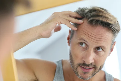 Hair Transplant