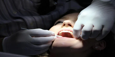 Understanding How Implant Abutment Works