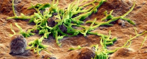 Dealing with allergies - types, diagnosis, and solutions