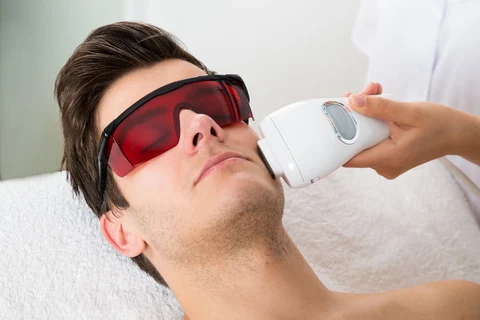 Laser hair removal: the answers to your questions
