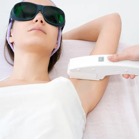 Laser hair removal: the answers to your questions