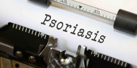 What does it mean to have psoriasis