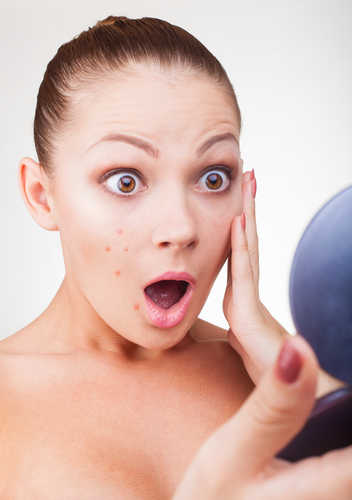 How to Get Rid of Severe Acne?