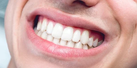Teeth