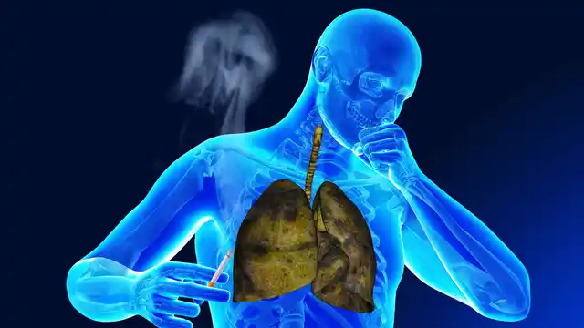 I operate upon lung cancer cases in adults as young as 29 years old. A large number of them have never smoked.