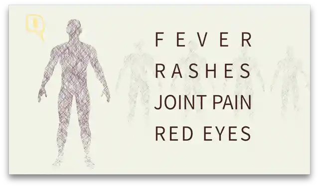 Symptoms of Zika virus
