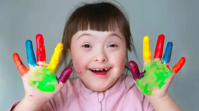 Down Syndrome (DS) is a genetic disorder that leads to mental issues and abnormal physical growth.