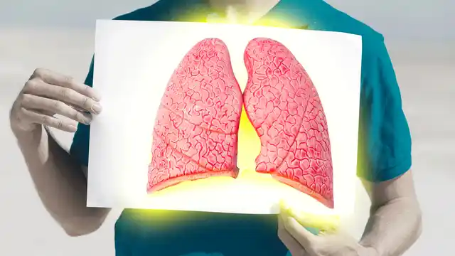 Lung cancer is the most common cancer diagnosed worldwide.