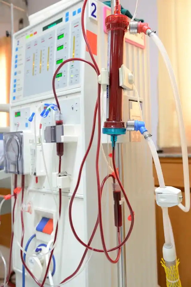This is a dialysis machine, it imitates the kidneys and patients on dialysis begin to feel better quickly but being chained to a machine to stay alive means that simple things like working full time, travelling become limited. (Photo: iStock)