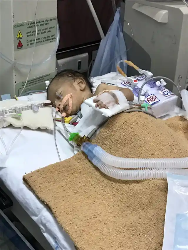 An unnamed baby, a rickshaw driver’s son, was operated upon when he was just three days old. (Photo: <b>The Quint</b>)