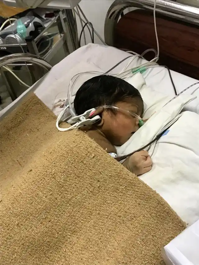 Baby of Surekha Prasad, a labourer, this little child was brought in from Trichur at the age of two days, when the referring doctor noticed blue discolouration and breathlessness. The child was operated upon when it was four days old. (Photo: <b>The Quint</b>)