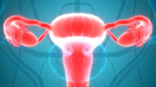 Most women are diagnosed in the advanced stages (3rd or 4th) of ovarian cancer.