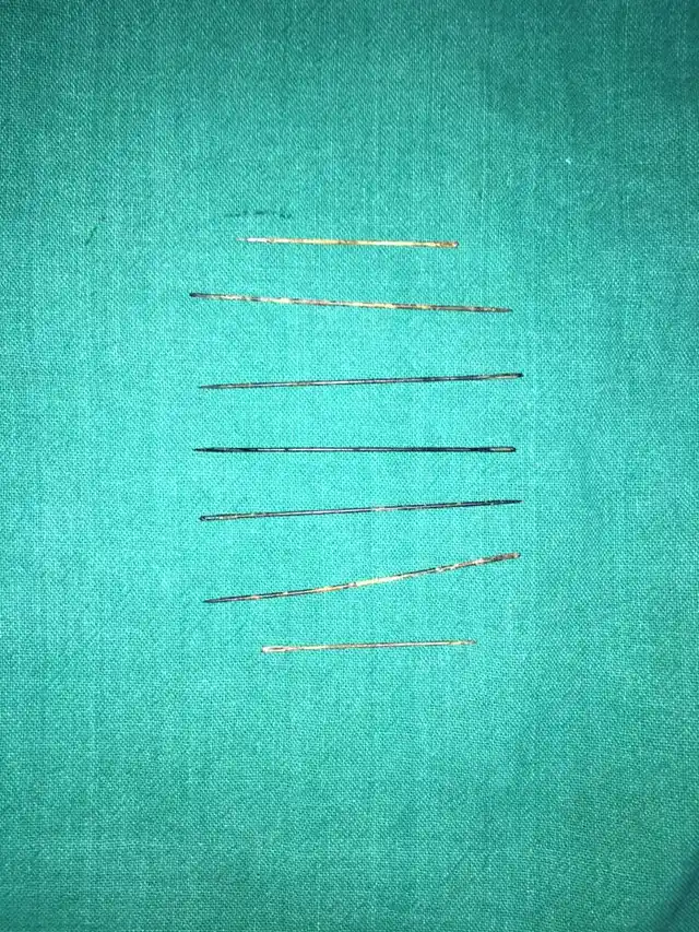 The needles removed from the body of the three-year-old.