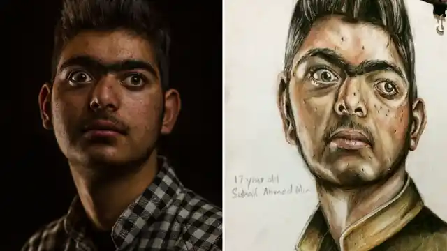 Portrait of 17-year-old pellet gun survivor, Suhail Ahmad.