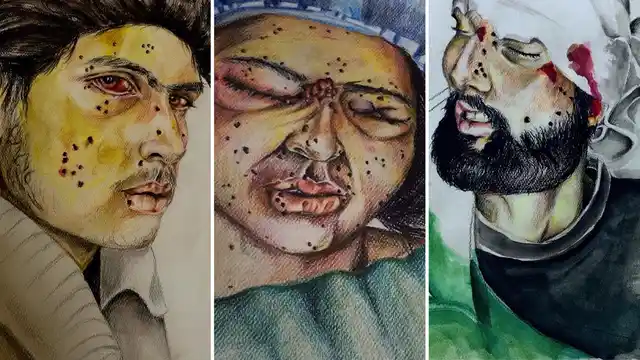 “They say it’s a non-lethal weapon”: portraits of pellet gun survivors.