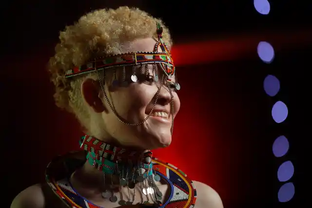 “People with albinism are people like any other, and for sure we are also beautiful,” Event Organizer Isaac Mwaura said. 