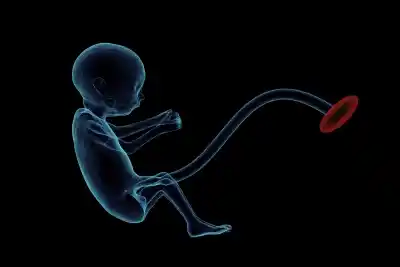 foetus.