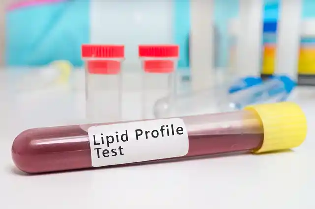 A simple blood check helps in detecting if the cholesterol level in the blood is under control.