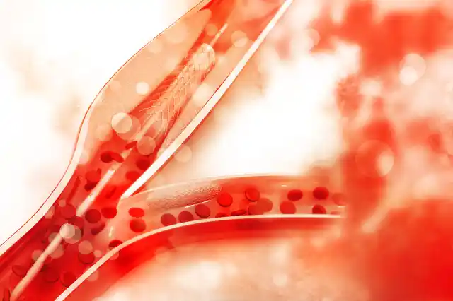 Stents are small expandable tubes used to treat narrowed or weakened arteries in the body.