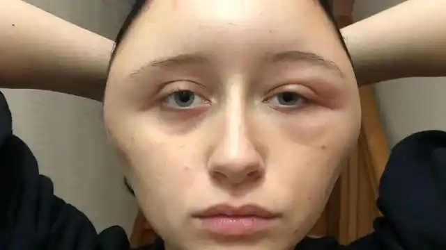 “I could not breathe.”
