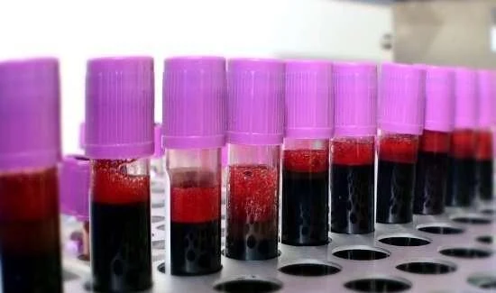 ரத்த வங்கிகளை கணினிமயமாக்கும் முடிவு - தமிழக சுகாதாரத்துறை நிதி ஒதுக்கீடு!
