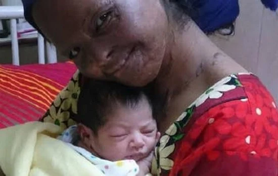 ஆசிட்டிற்கு எதிரான சிறு புன்னகை!