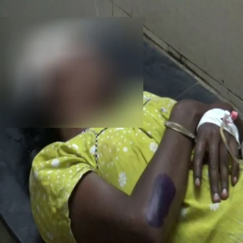 இயற்கை உபாதைக்காகப் பேருந்தை நிறுத்தாத ஓட்டுநர், நடத்துநர் - ஓடும் பேருந்தில் இருந்து குதித்த பெண் படுகாயம்!
