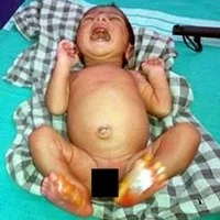 அண்ணனை போல் தம்பி உடலும் தானாக பற்றி எரியும் தீ: மீண்டும் திகிலில் நெடிமொழியனுர் கிராமம்!