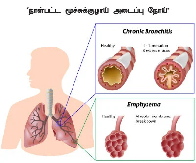 புகையை சுவாசித்தால்...