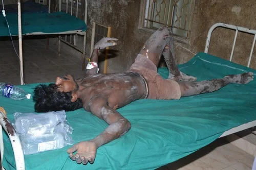 நடை பிணங்களாய் நடமாடும் பட்டாசு ஆலை தொழிலாளர்கள் - நெஞ்சை பிழியும் விருதுநகர் அவலம்