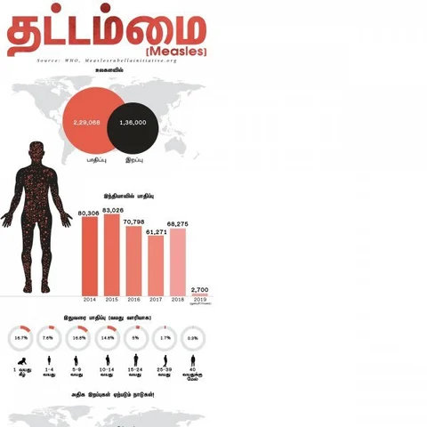 வெயில்கால தட்டம்மை நோயைத் தவிர்க்க என்ன செய்ய வேண்டும்? #Measles