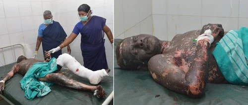 சிவகாசி அருகே பட்டாசு ஆலையில் வெடிவிபத்து: 3 பேர் பலி! (படங்கள்)