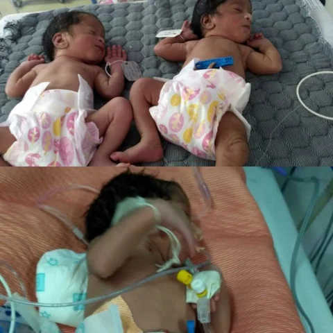 மகளிர் தினத்தில் ஒரே பிரசவத்தில் பிறந்த 3 பெண் குழந்தைகள்! - கோவையில் கேக் வெட்டிக் கொண்டாட்டம்