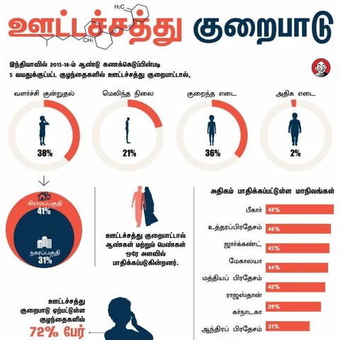 27 சதவிகித தமிழகக் குழந்தைகளை வதைக்கும் ஊட்டச்சத்துக் குறைபாடு! #Alert